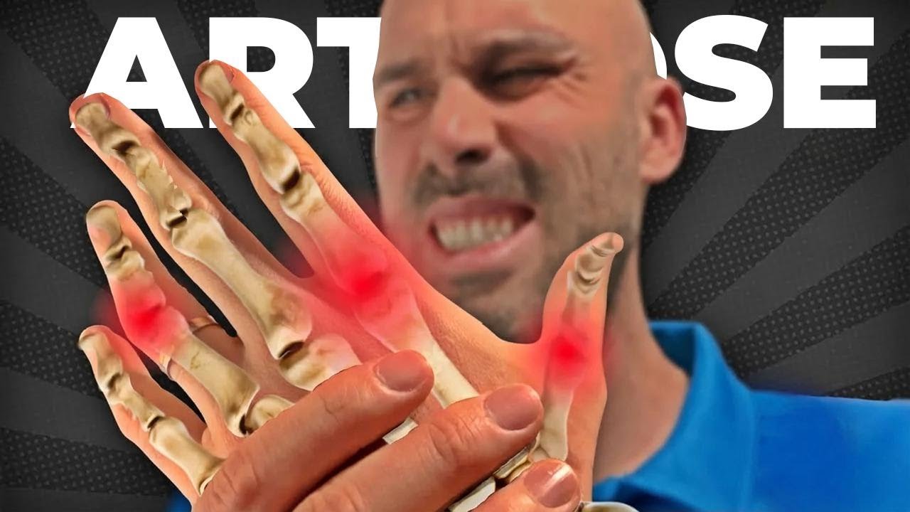 6 exercícios fáceis para aliviar a artrose nas mãos e dedos