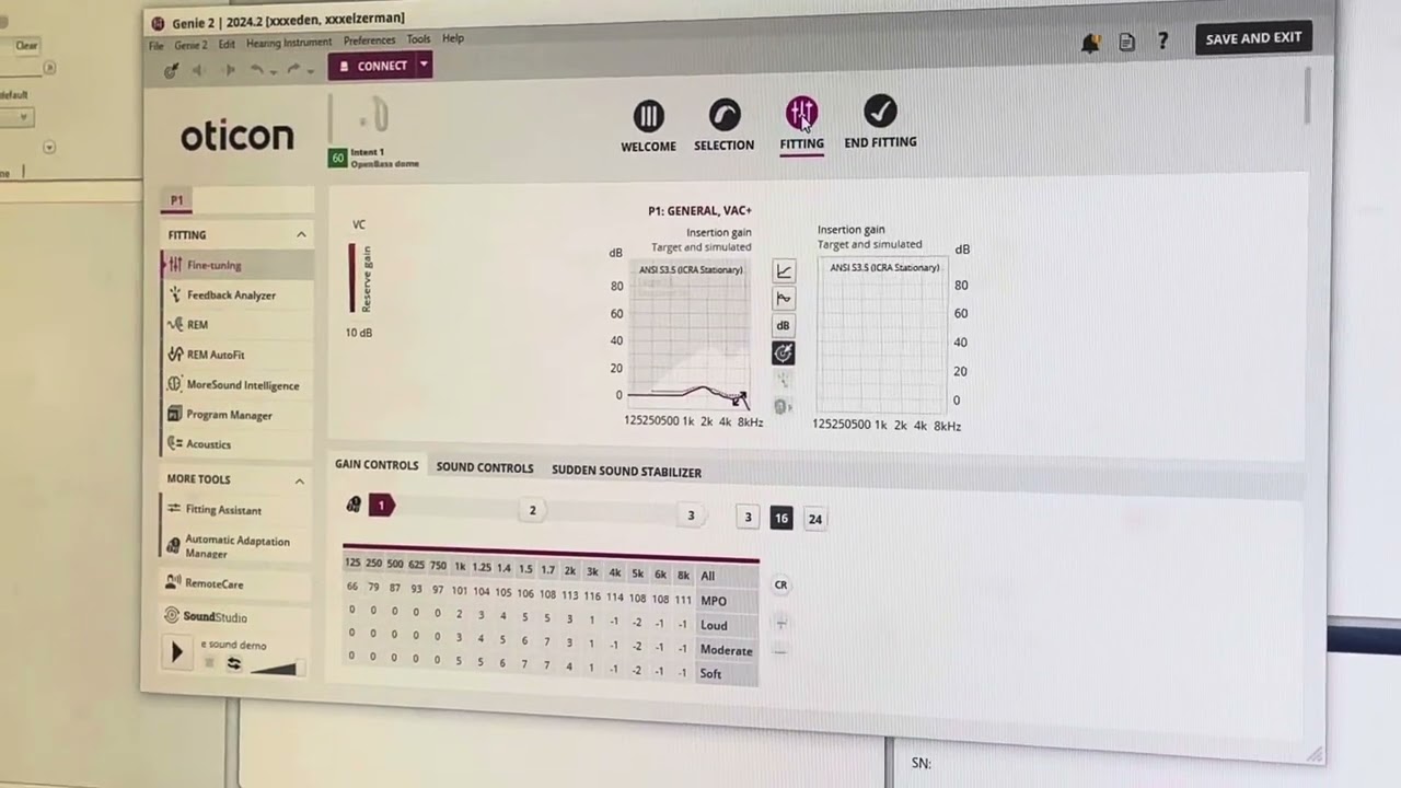 Preprogramming for Oticon Hearing Aids