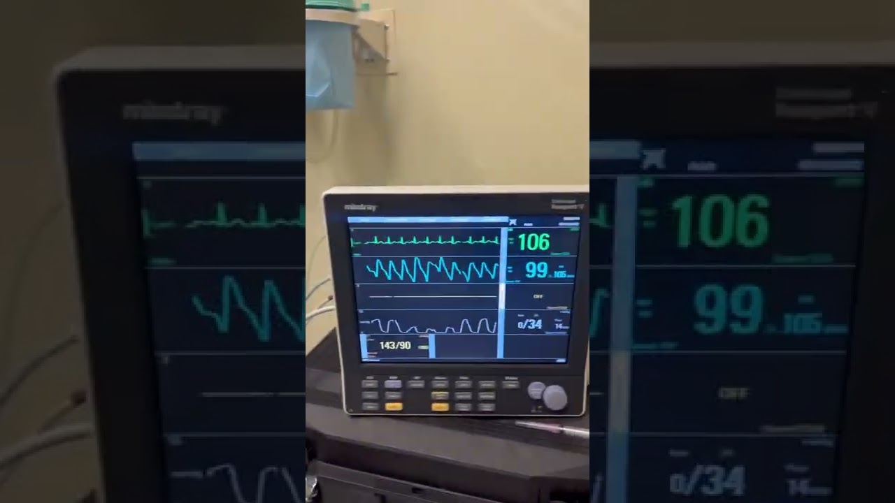 Dental Anesthesia in the office POV- monitor, meds, & approach.
