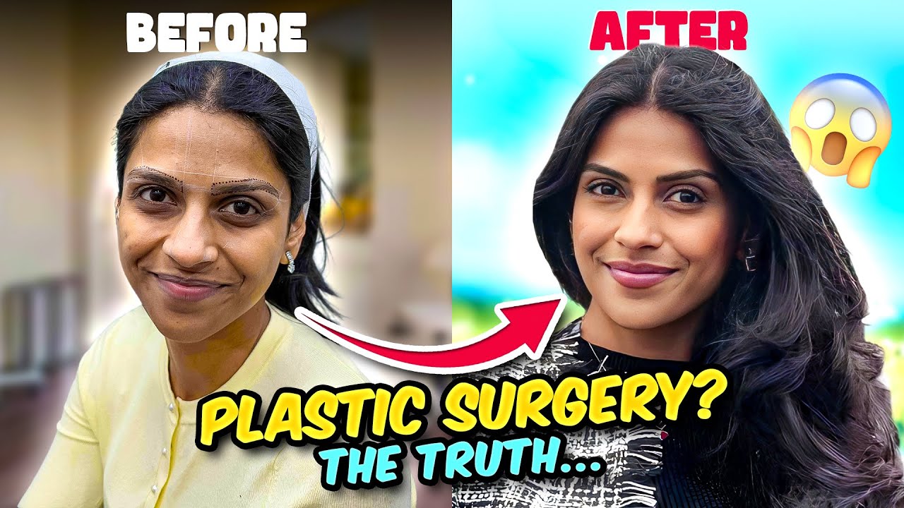 My Plastic Surgery Story | Swarda Thigale