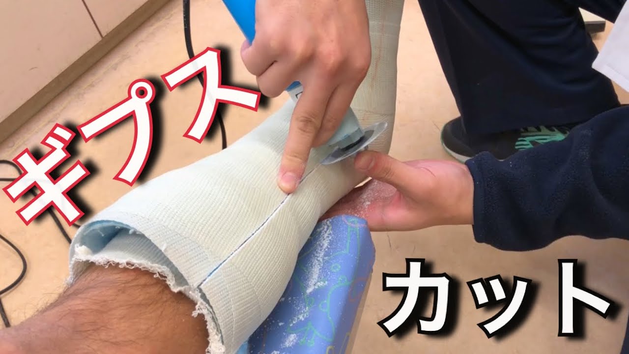 【痛い？！】ギプスをカットしてもらいました。