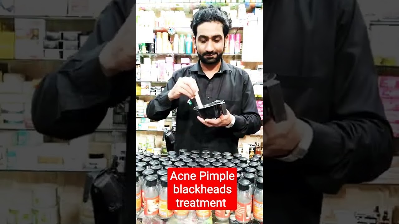 Acne Pimple blackheads treatment | acne | pimple| blackhead | Abdullah beauty expert | MyLife