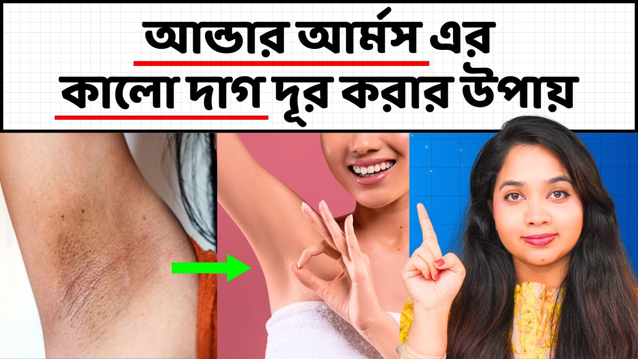 ঘরে বসেই আন্ডারআর্মস / বগলের কালো দাগ দূর করার টিপস! How to Lighten Dark Underarms?