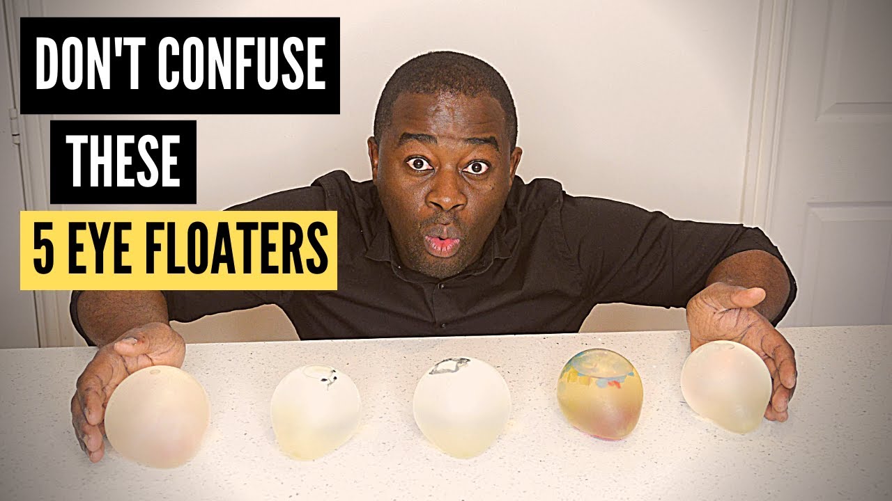 5 Common Eye Floaters symptoms and eye floaters treatment options