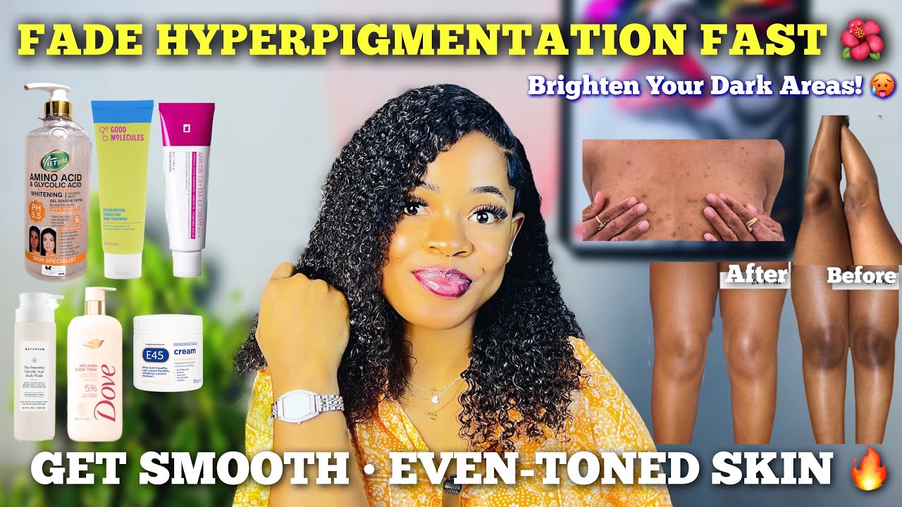 How to Fade Body Hyperpigmentation FAST! 🌙 Affordable Skincare Routine for Dark Spots & Uneven Skin