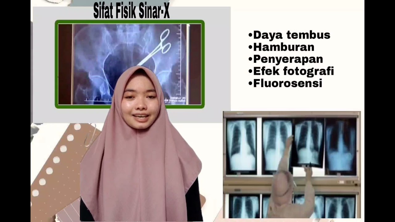 PROSES TERJADINYA SINAR X #ProjectProteksiRadiasi #Sinar-x