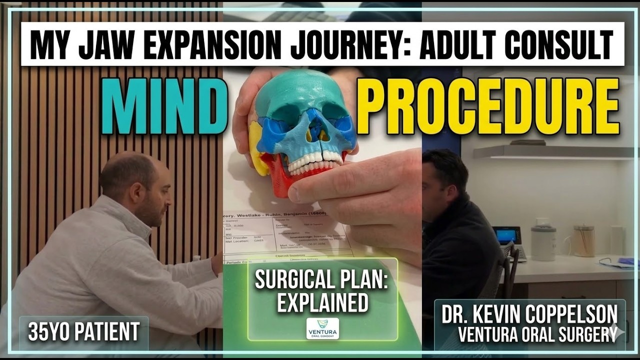 MIND Surgery Consultation with Dr. Kevin Coppelson | Ventura Oral Surgery