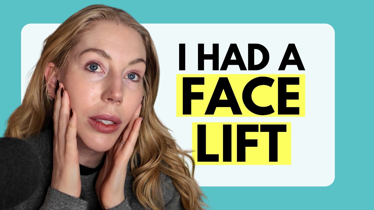 I HAD A FACELIFT IN MY 40's...