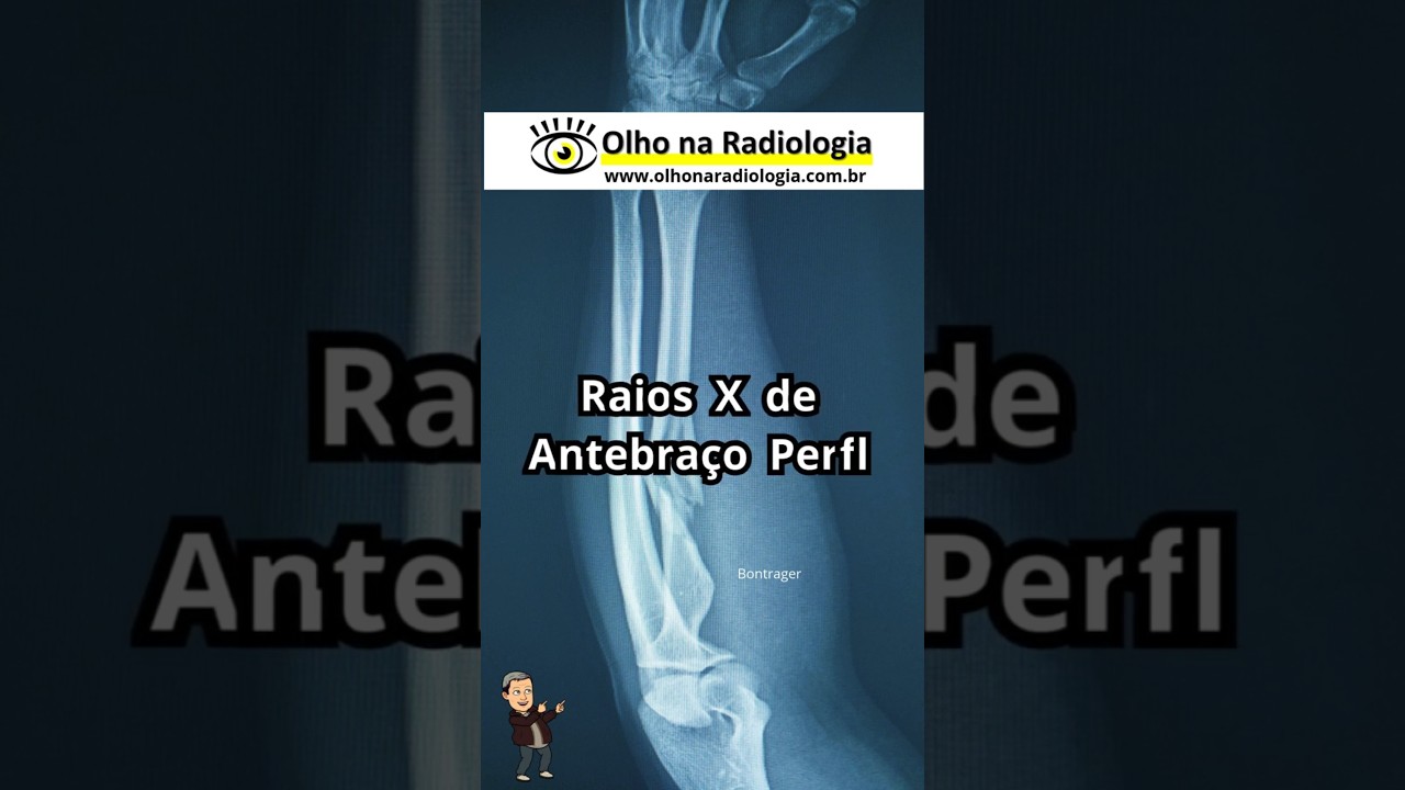 RAIOS X DE ANTEBRAÇO (PERFIL) 