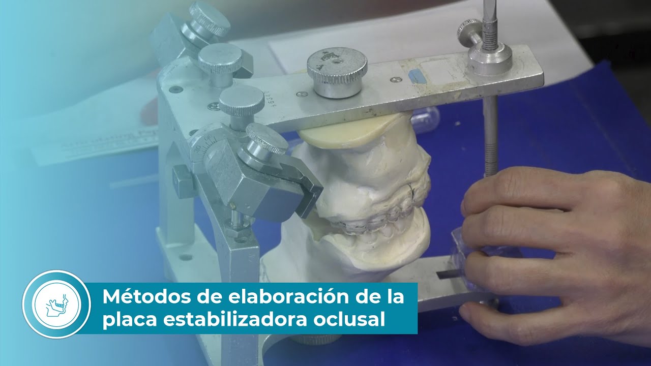 M&eacute;todos de elaboraci&oacute;n de la placa estabilizadora oclusal