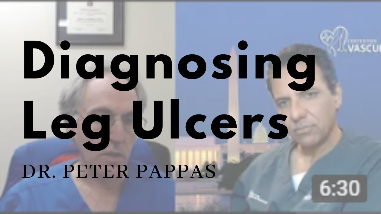 Diagnosing Leg Ulcers by Dr. Peter Pappas | Treatment for Leg Ulcer That Will Not Heal