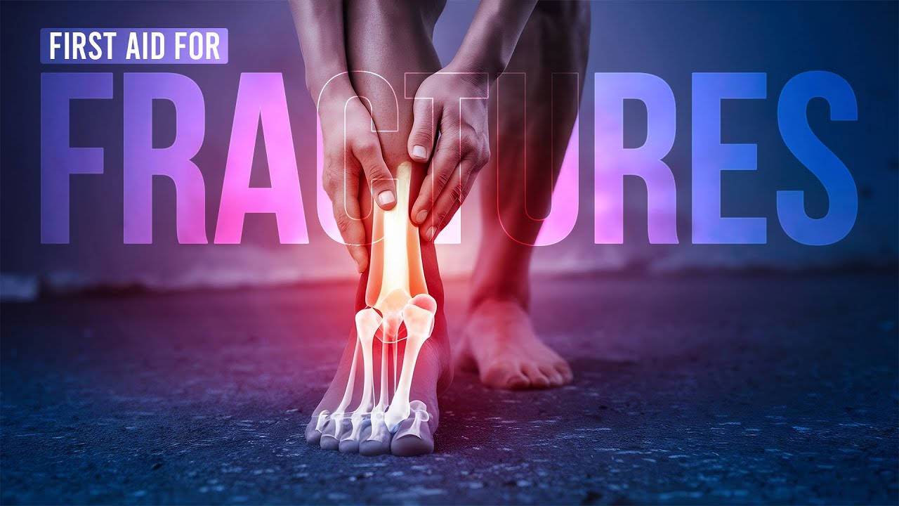 Apollo Hospitals | Immediate Care for Broken Bones: What to Do | First Aid Tips