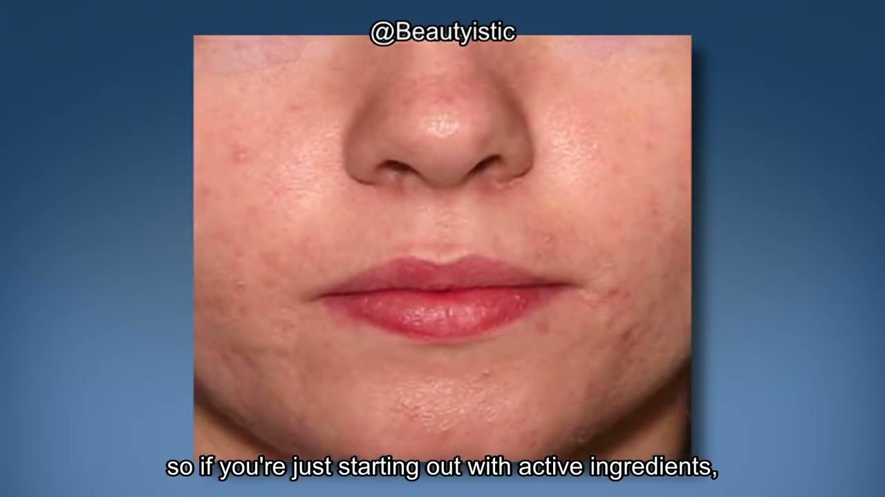 iS CLINICAL Active Serum Review: Does It Really Even Skin Tone & Combat Acne?