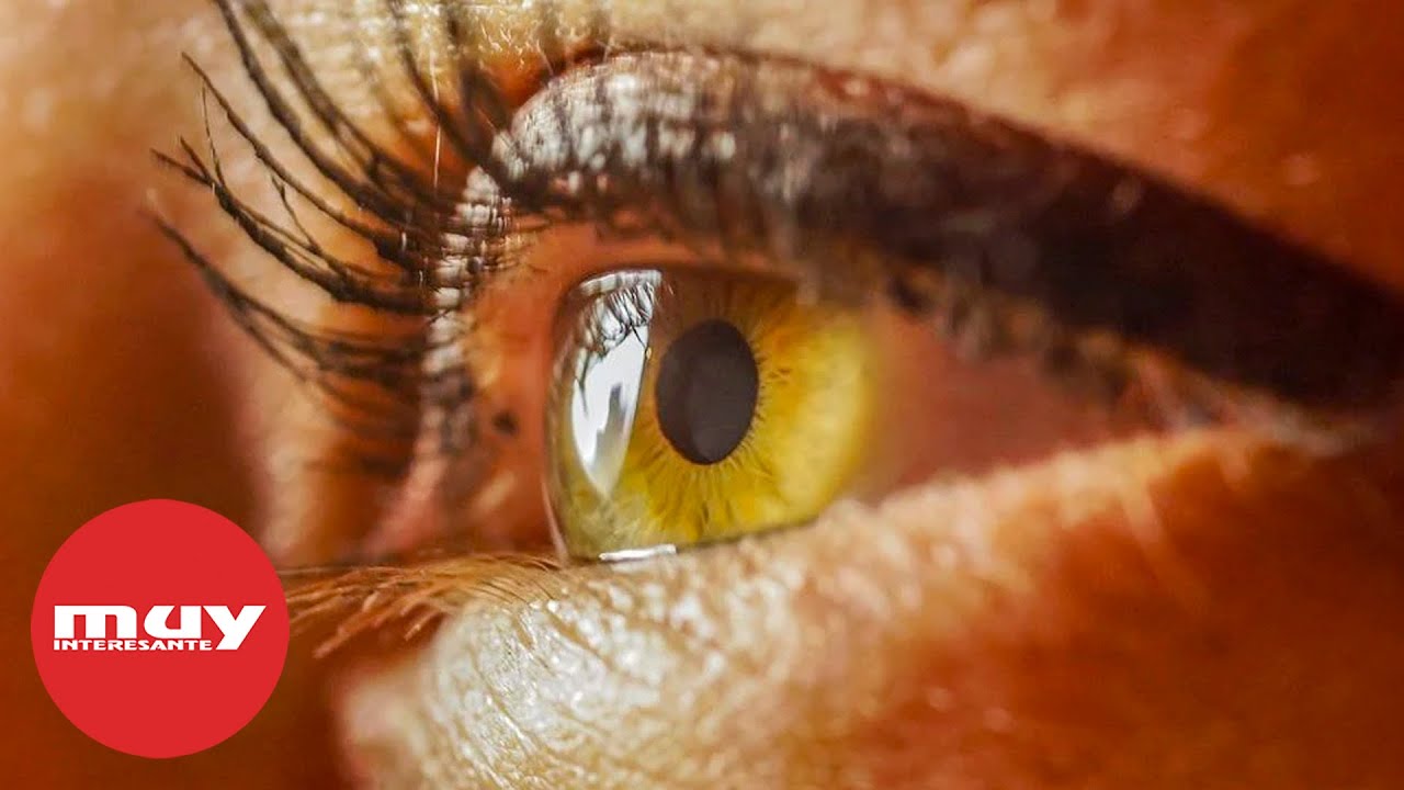 &iquest;Sufres afantas&iacute;a? Tus ojos pueden delatarlo