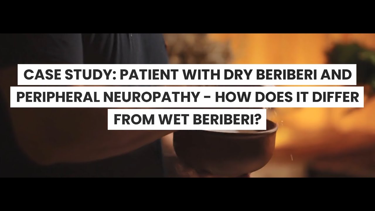 Beriberi in thiamine deficiency (vitamin B1) How does dry beriberi different from wet beriberi?