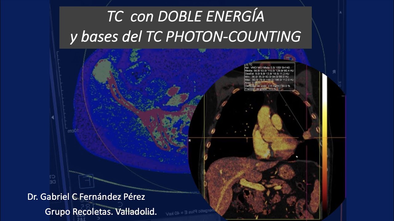 216- TC con energia dual y bases del TC photon-counting