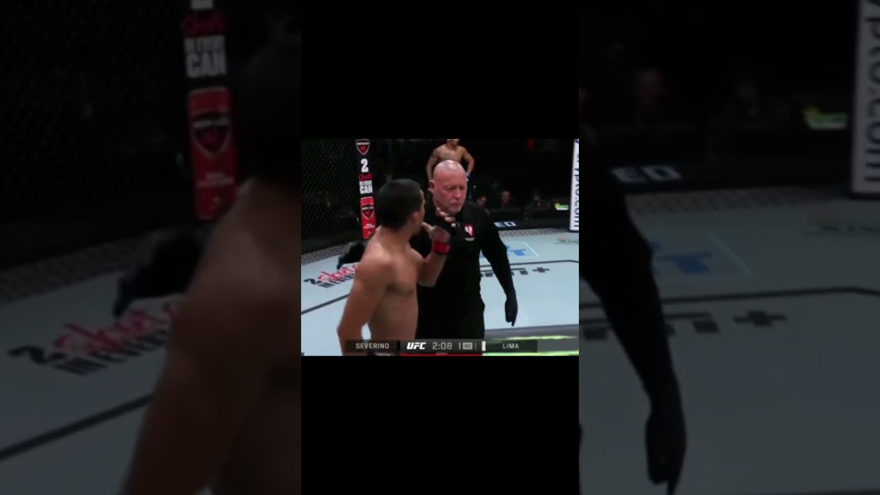 Igor Severino Bites Andre Lima UFC Fight Night. Mike Tyson Taught Him Well!!! 😳😮