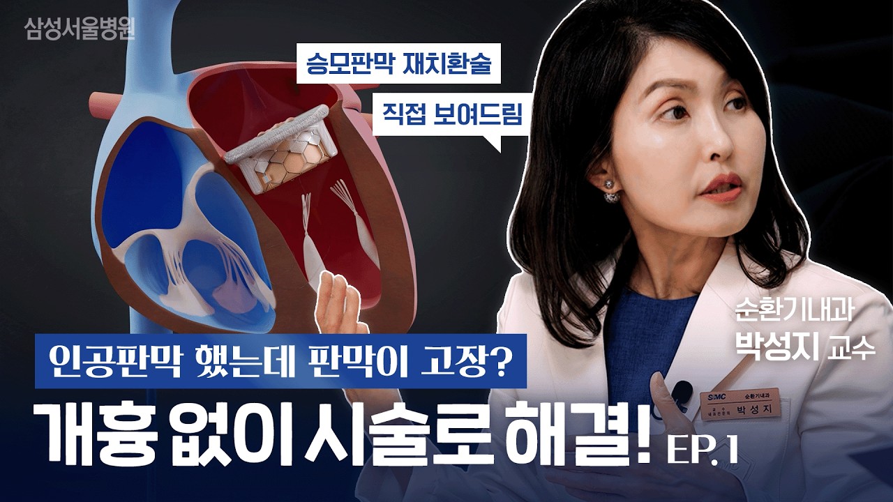 판막이 다시 고장 났는데 수술이 부담된다면? 개흉 없이 하는 승모판막 재치환술 🫀