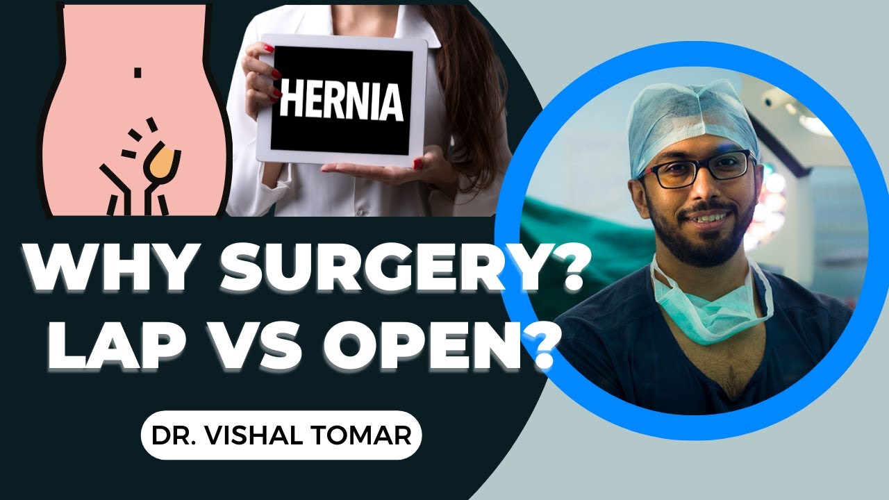 Treat Hernia Without Surgery? | Diet and Lifestyle Explained | Hindi | Dr. Vishal Tomar