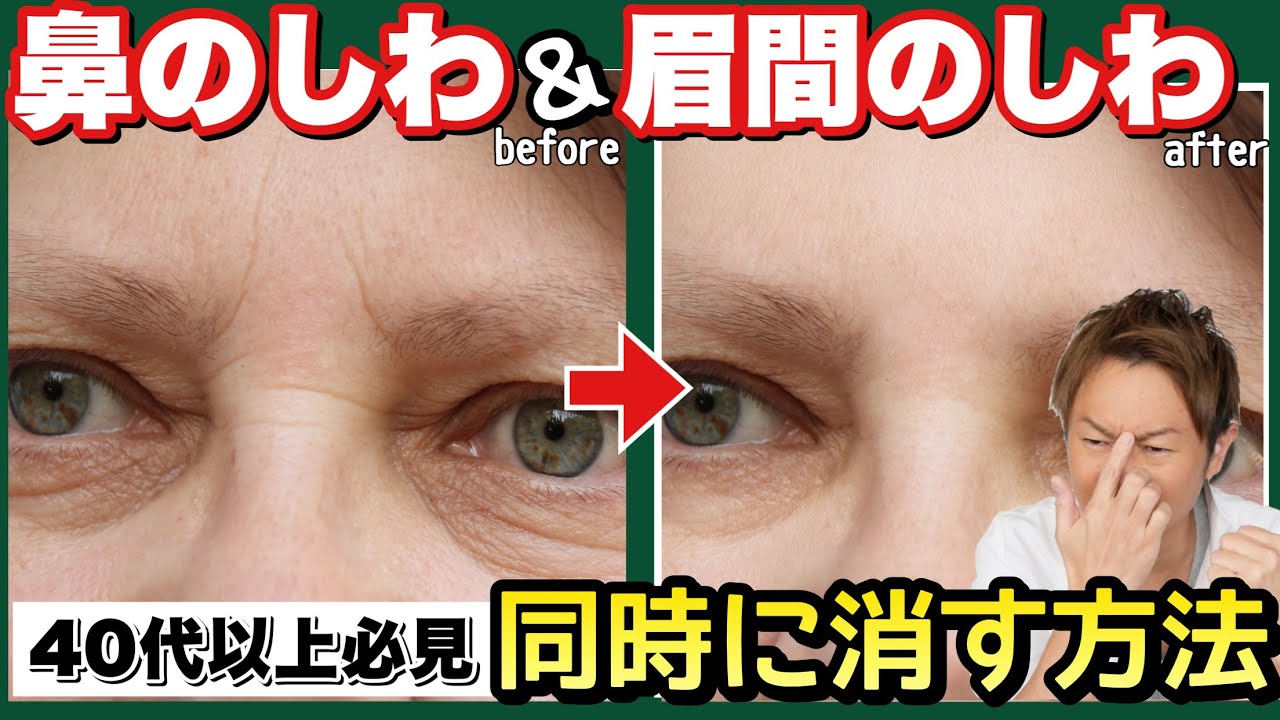 眉間のしわ！鼻のしわはめちゃくちゃ簡単に消せます！