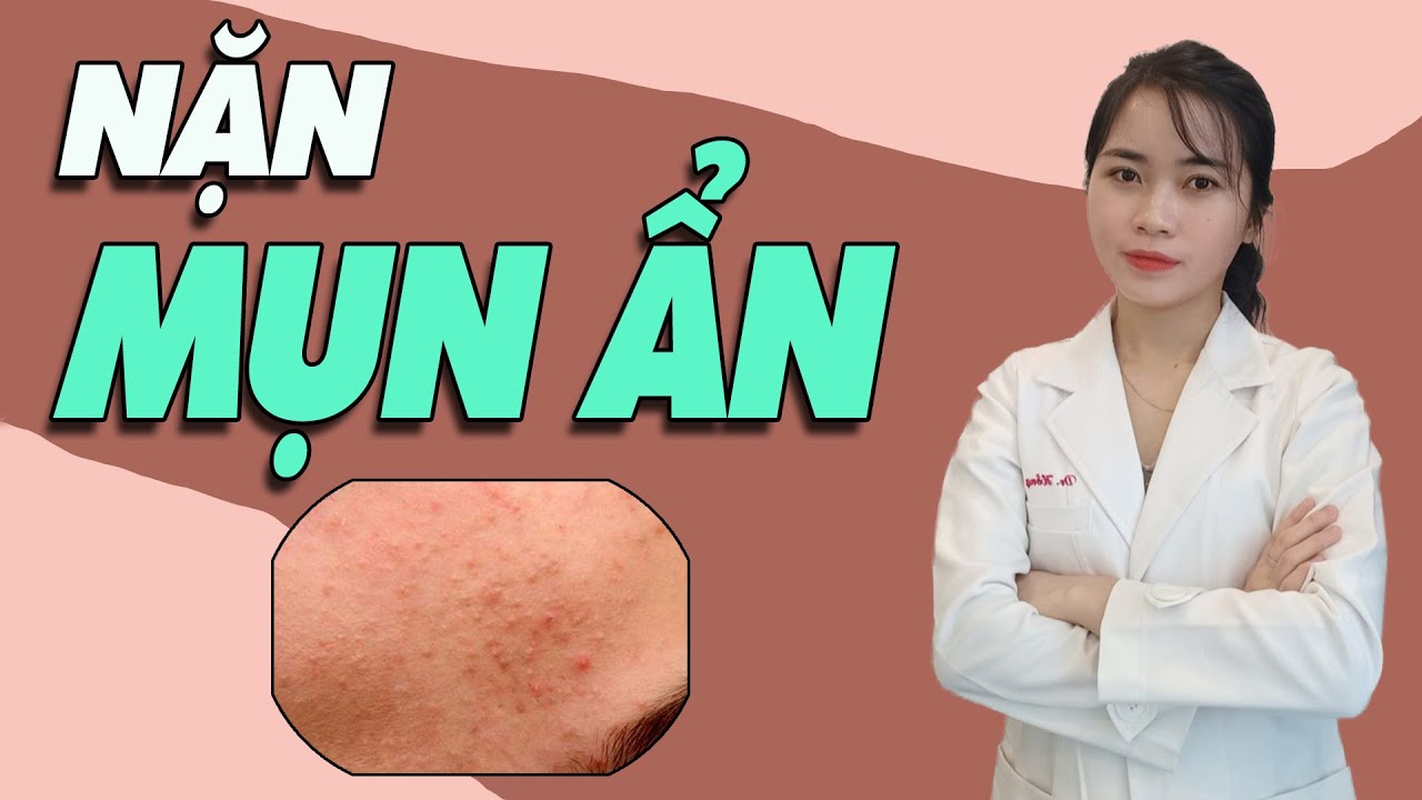 Ngừng NẶN MỤN ẨN theo cách cũ mà hãy làm 5 bước sau để TRỊ MỤN ẨN hiệu quả| Bs Nguyễn Ngọc
