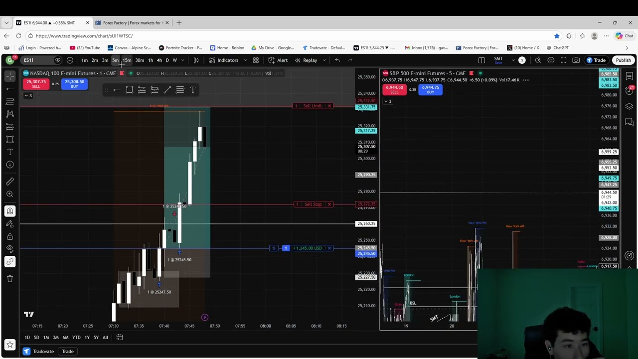 Live Trading Session 2/25/26