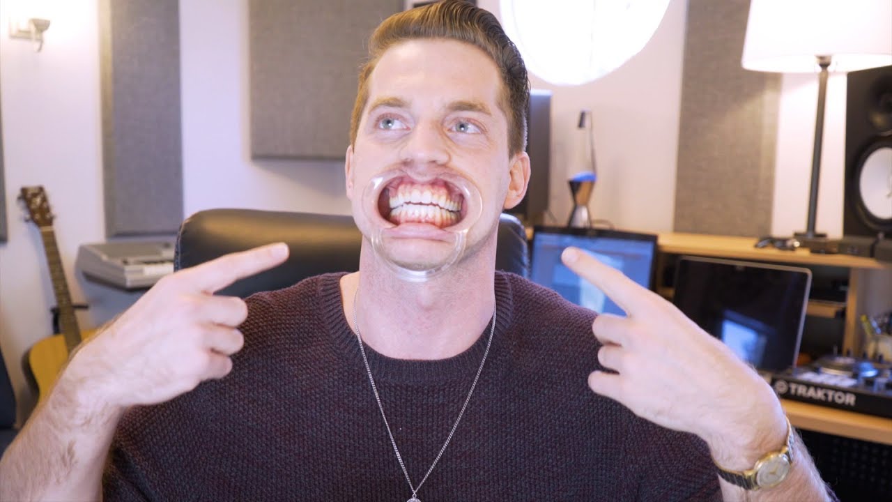 Dental Mouth Opener Challenge: Beatbox Edition w/ 80Fitz
