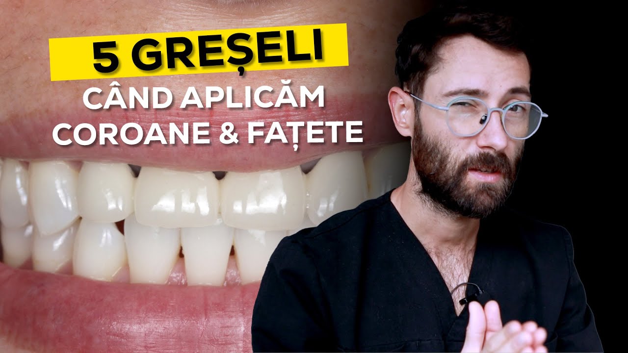5 GRESELI LA APLICAREA FATETELOR