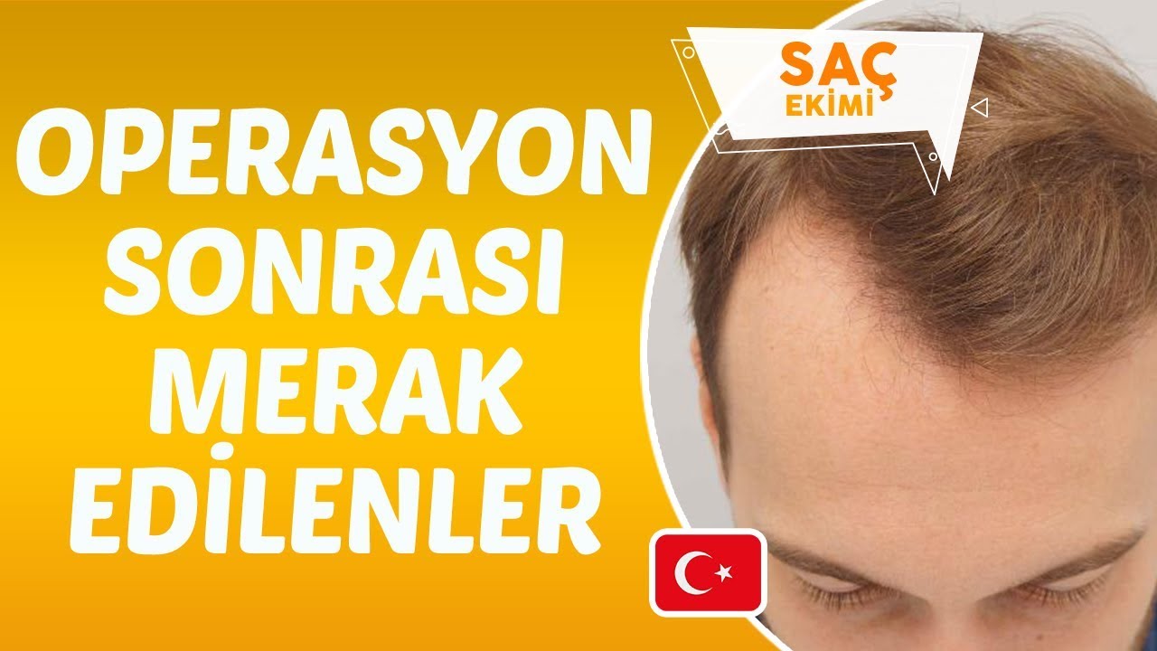 Saç Ekimi Operasyonu Sonrası Dikkat Edilmesi Gerekenler Nelerdir? - Dr. Hamid AYDIN