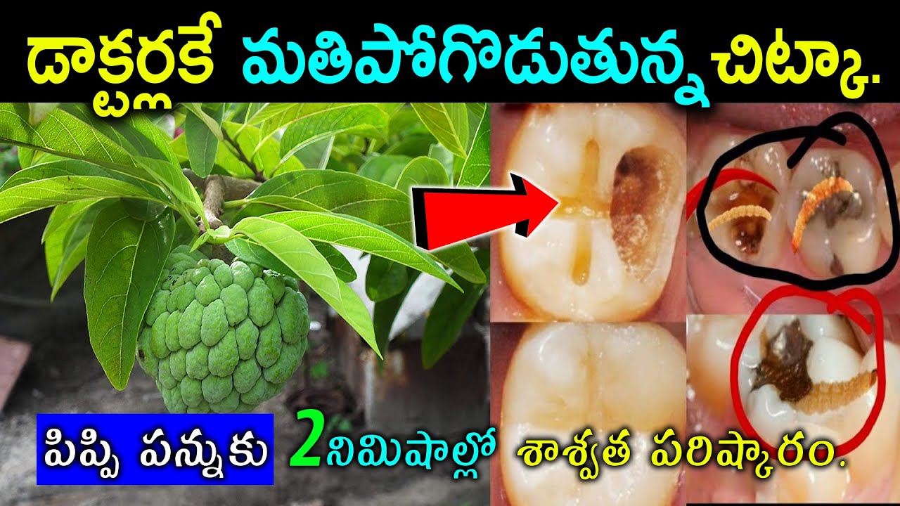 డాక్టర్లకే మతిపోగొడుతున్న చిట్కా || how to cure cavities naturally in Telugu #kskhome