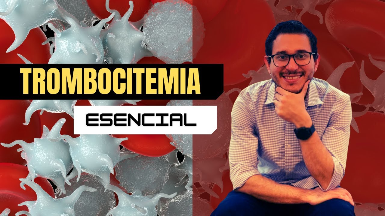 Trombocitemia Esencial - Eidikología #4