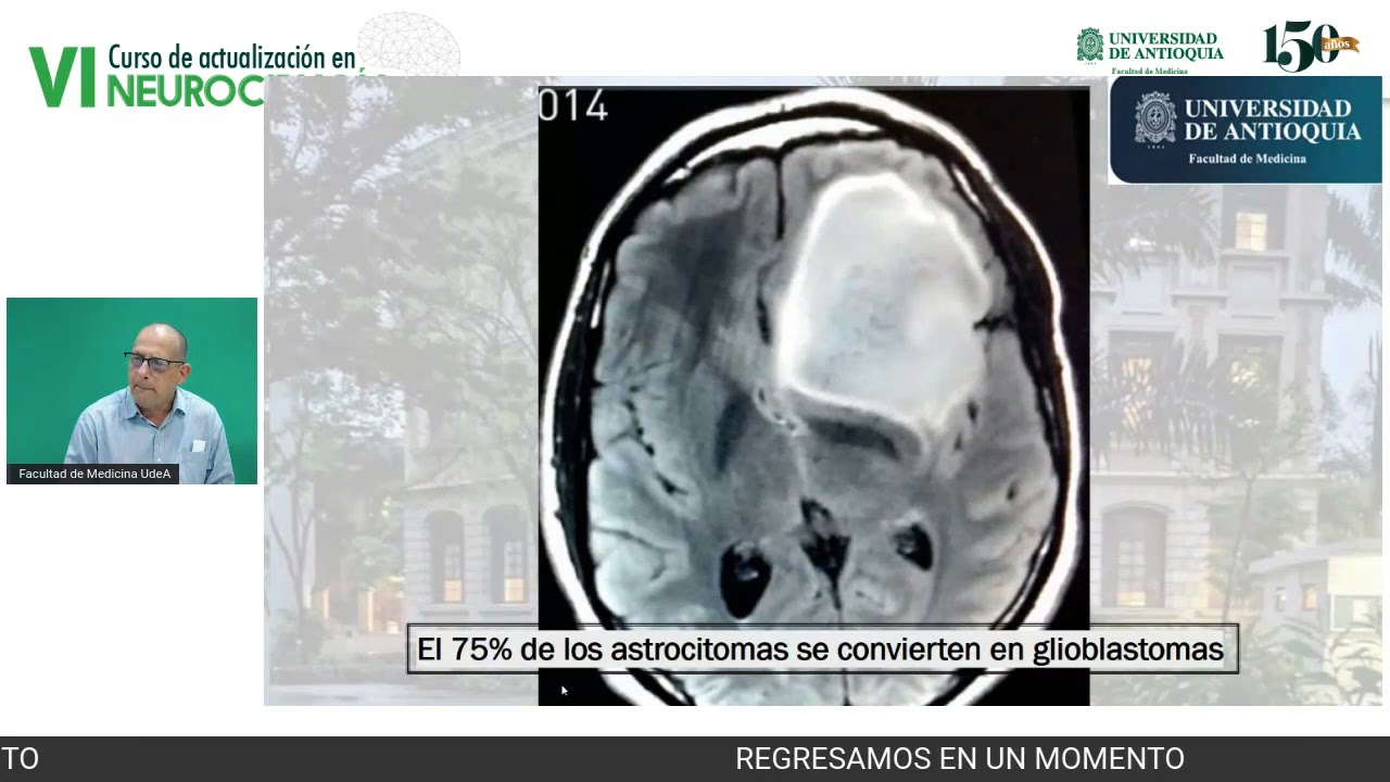 TUMORES CEREBRALES