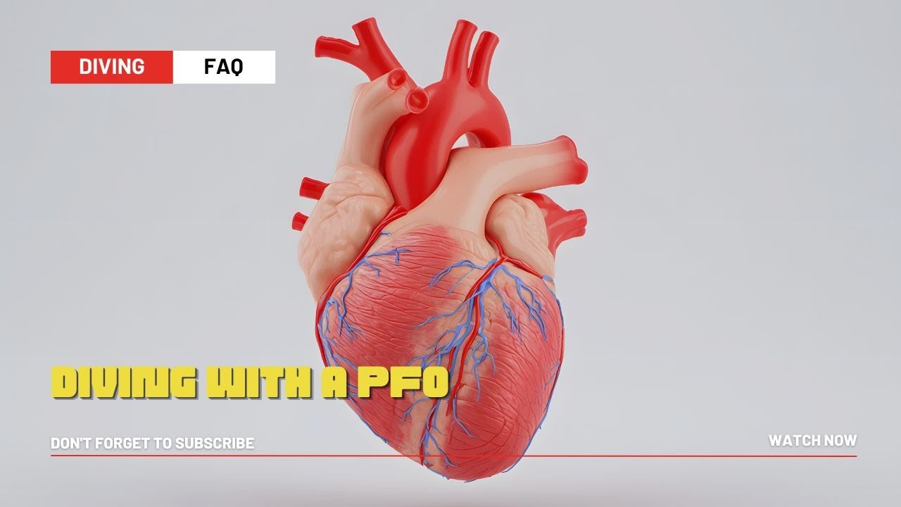 Diving with a PFO