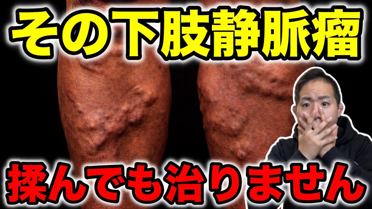【静脈留】整体やマッサージなんかで治るわけがない