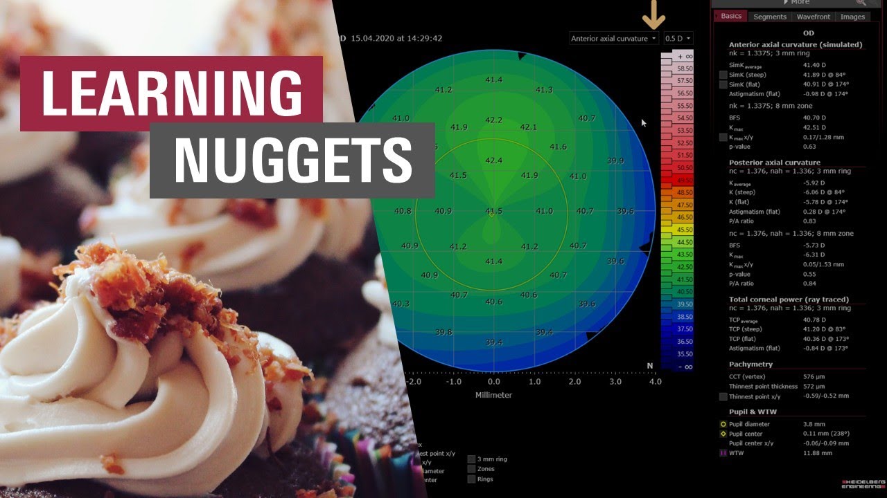🇺🇸 Cornea App: Acquisition & Analysis | ANTERION