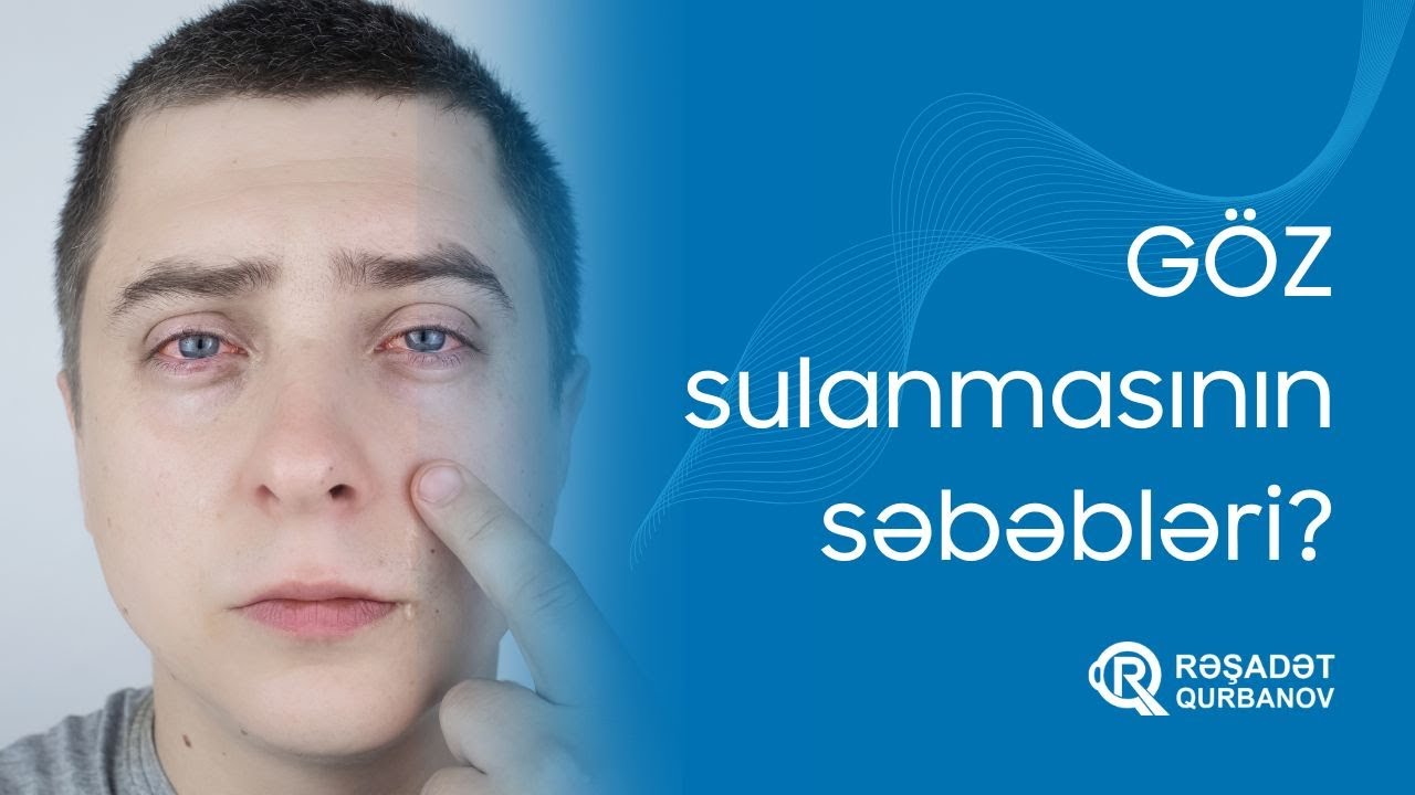 Göz sulanmasının səbəbləri nədir? Oftalmoloq Dr. Rəşadət Qurbanov.