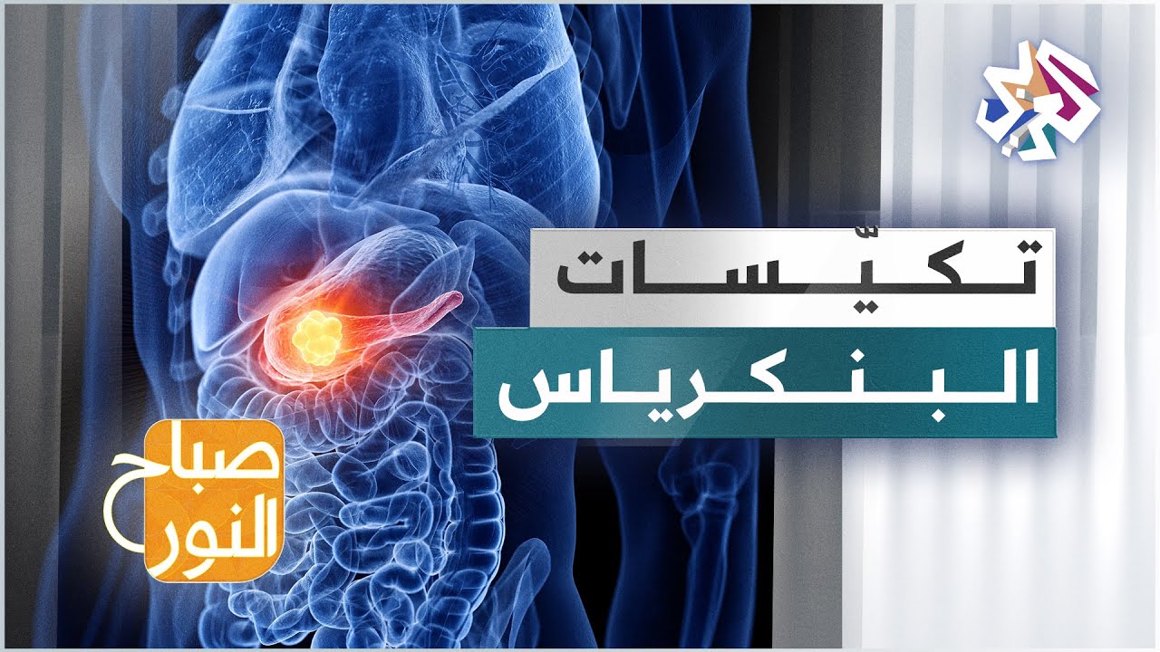 تكيّسات البنكرياس .. الأسباب والعلاجات