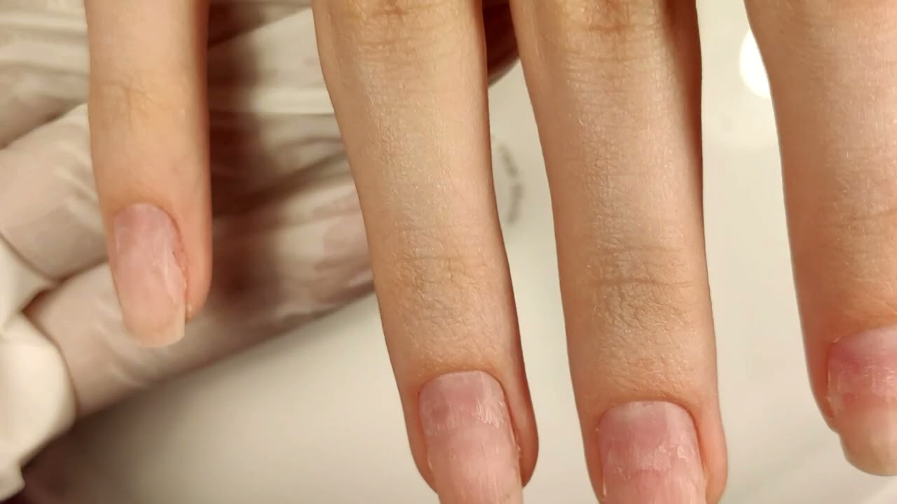 Коррекция ногтей гелем, короткий квадрат.