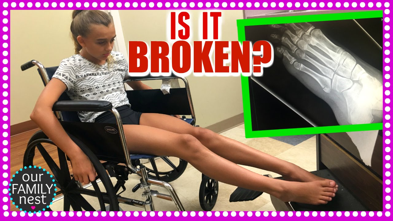 DANCE INJURY - BROKEN METATARSAL :(