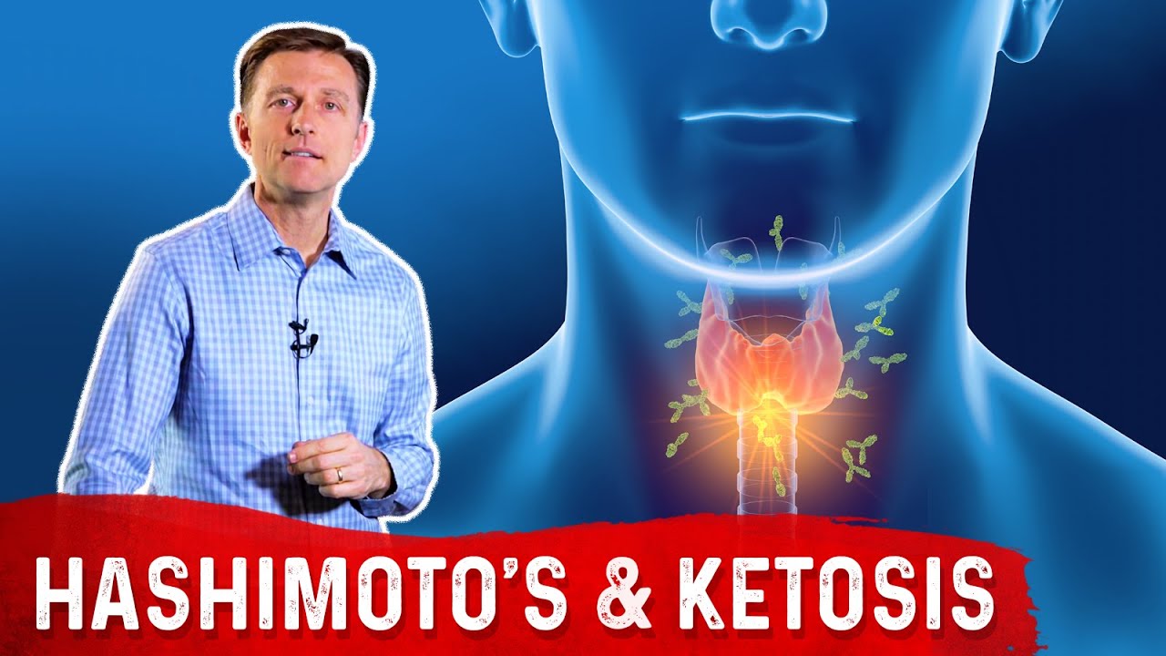 Hashimoto's Disease (Hypothyroid) and Keto (Ketogenic Diet) &ndash; Dr. Berg