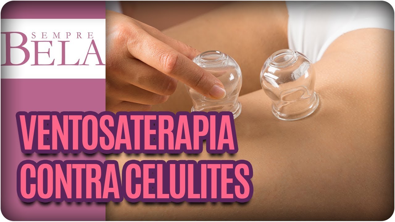 Como funciona a Ventosaterapia contra celulites?- Sempre Bela (10/12/17)