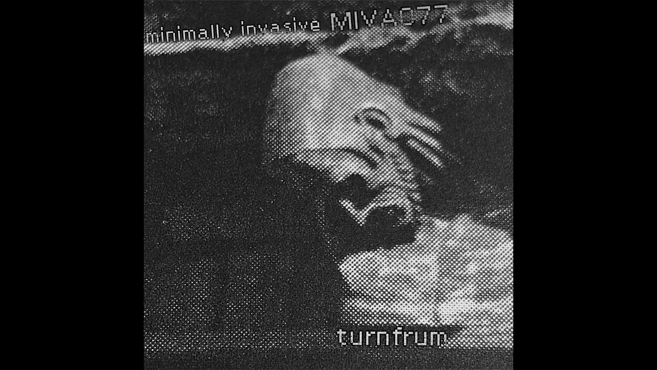 Minimally Invasive 077 Turnfrum [MIVA077] #minimal #techno #electro