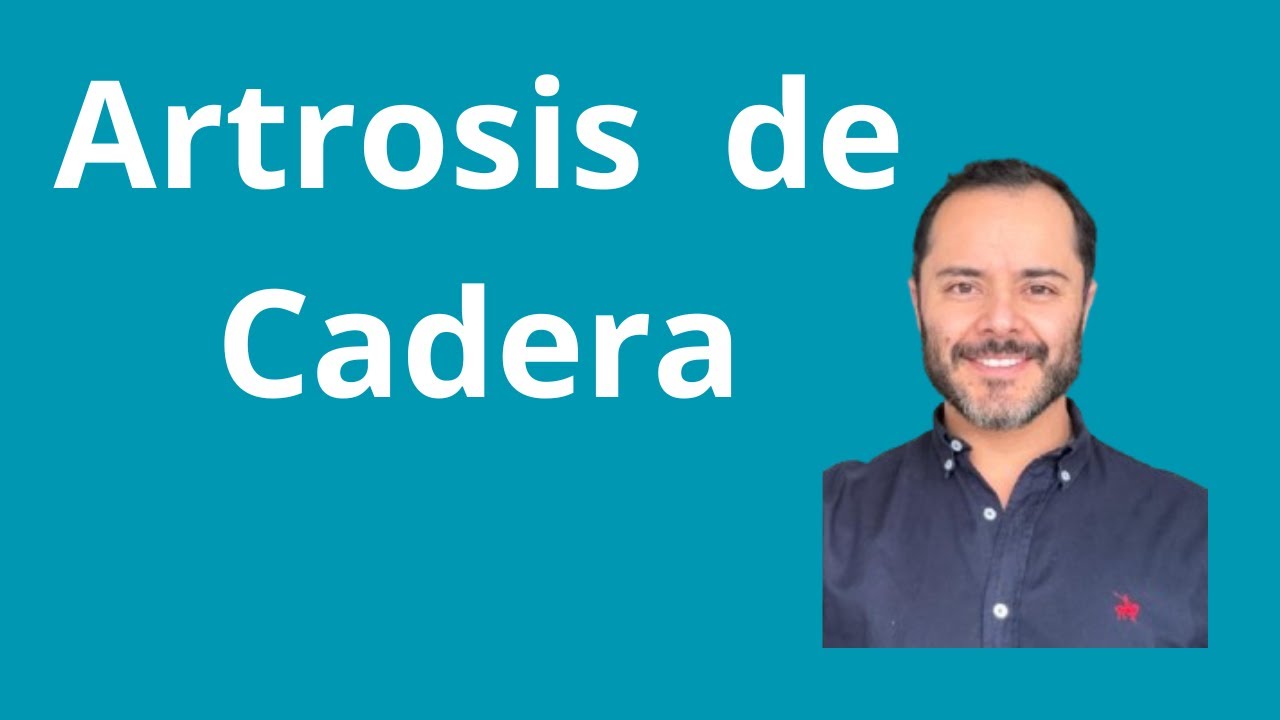 Dolor en la ingle: Artrosis de cadera | Preguntas de examen que siempre caen (en 9 minutos)