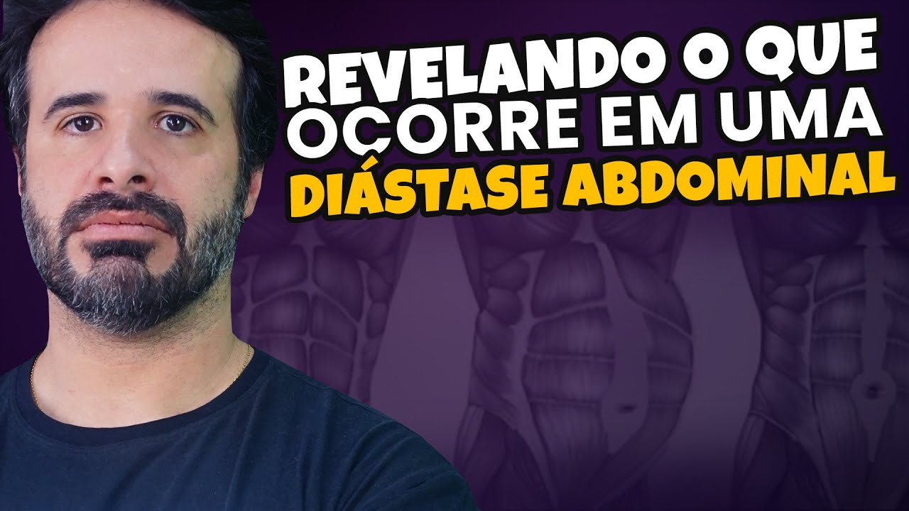 REVELANDO O QUE OCORRE EM UMA DIÁSTASE ABDOMINAL.