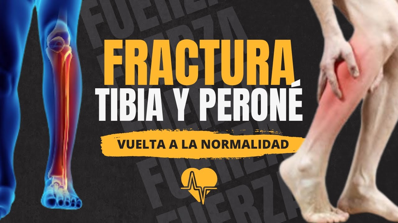 Fractura de tibia y peroné: Vuelta a la normalidad