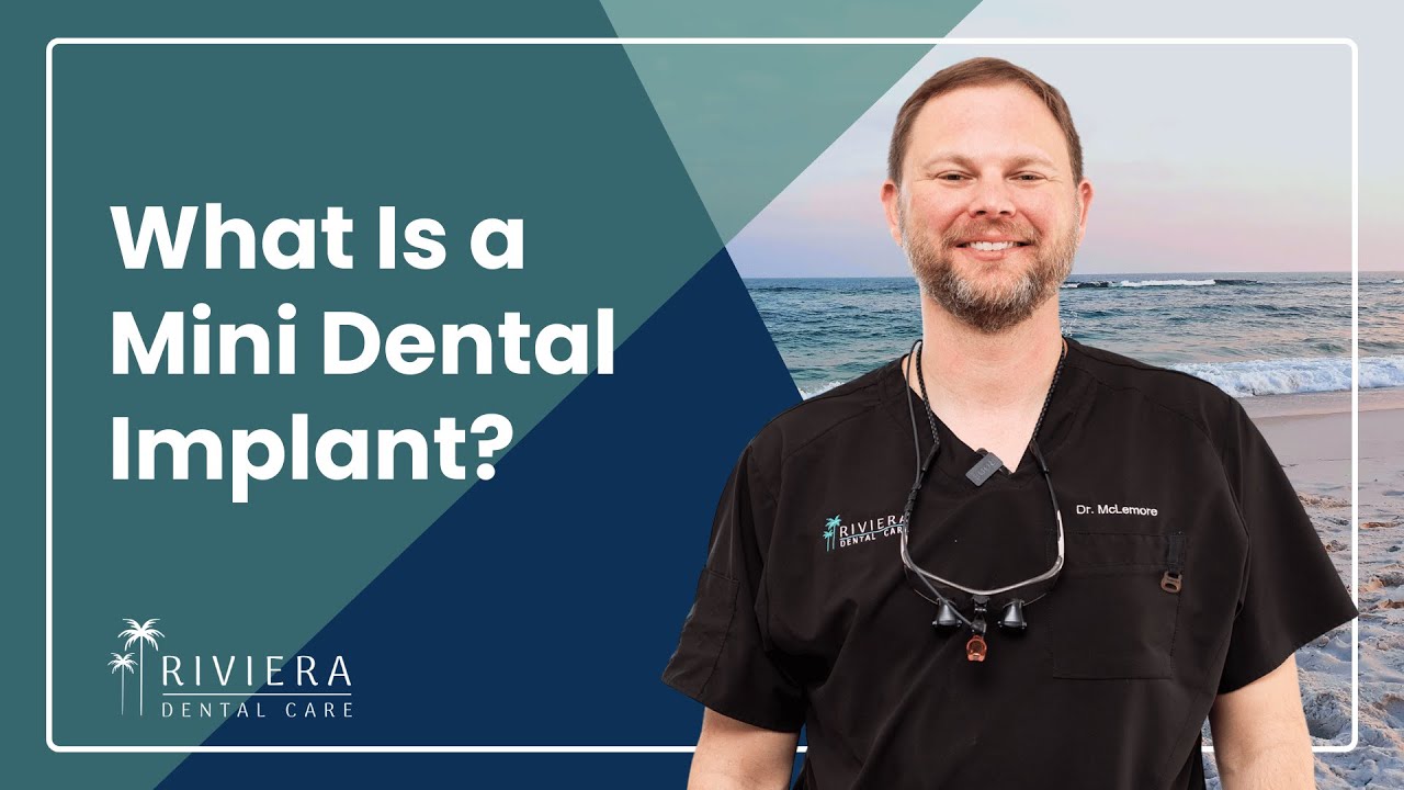What Is a Mini Dental Implant? | Dental Implants in Foley, AL | Riviera Dental Care