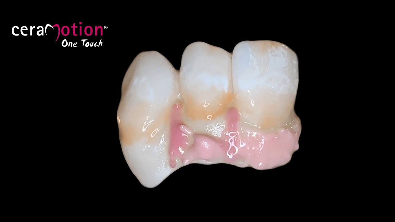 Ceramotion One Touch de Dentaurum