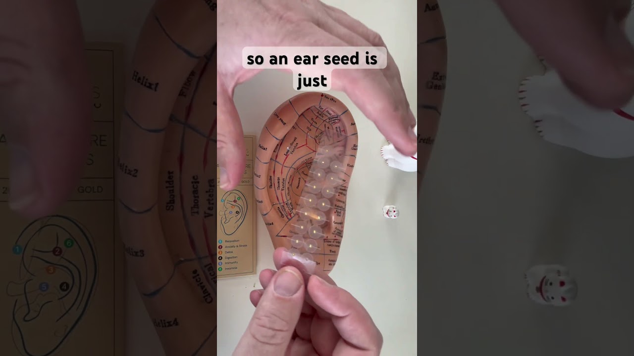 How to reduce jaw pain #earseeds #jawpain