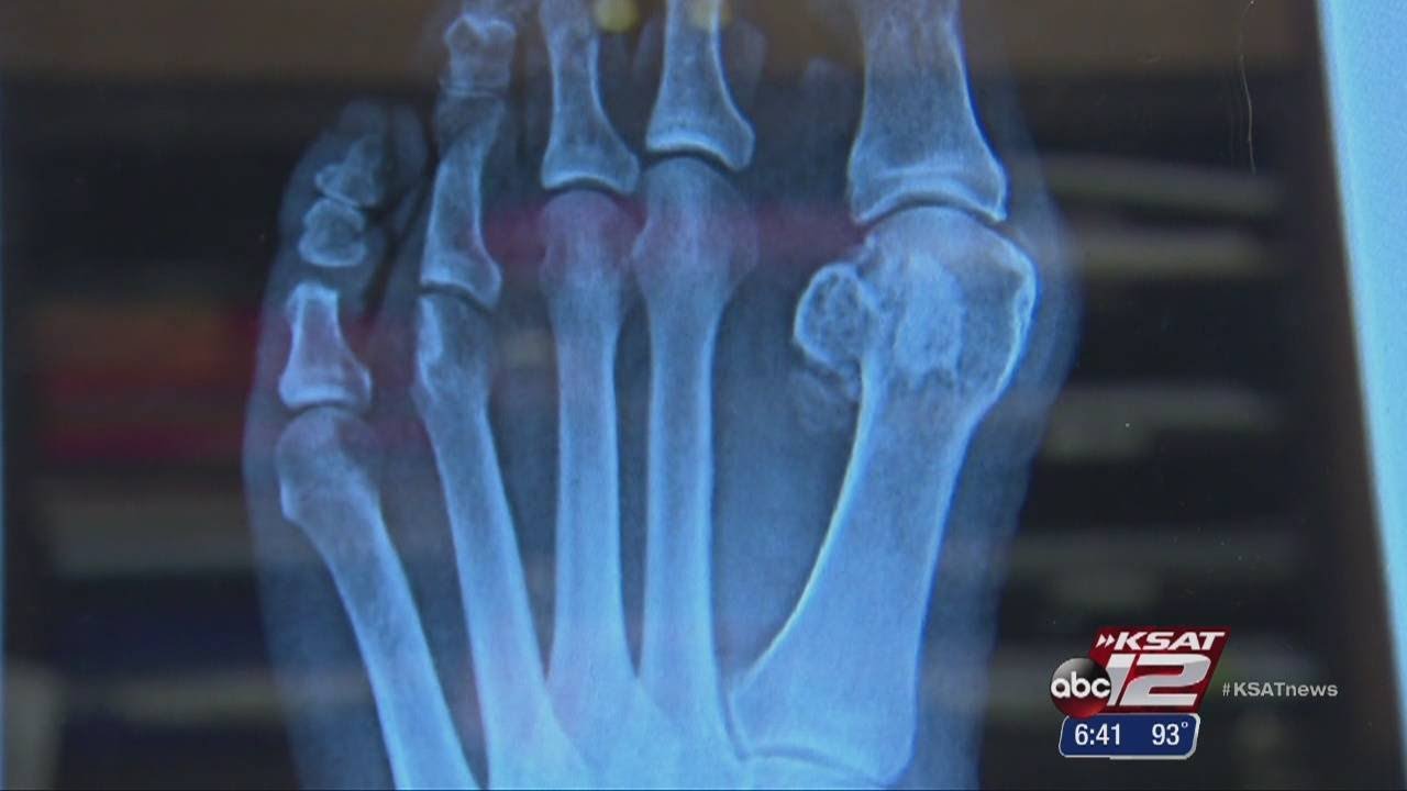 Report: High heels could be causing health problems