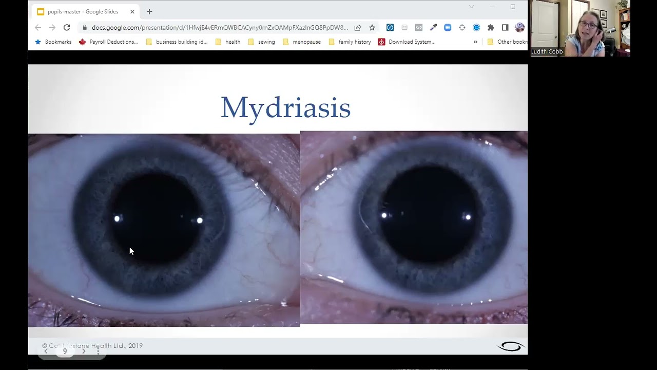 [iridology mini-class] Pupils - what they add to an iris assessment